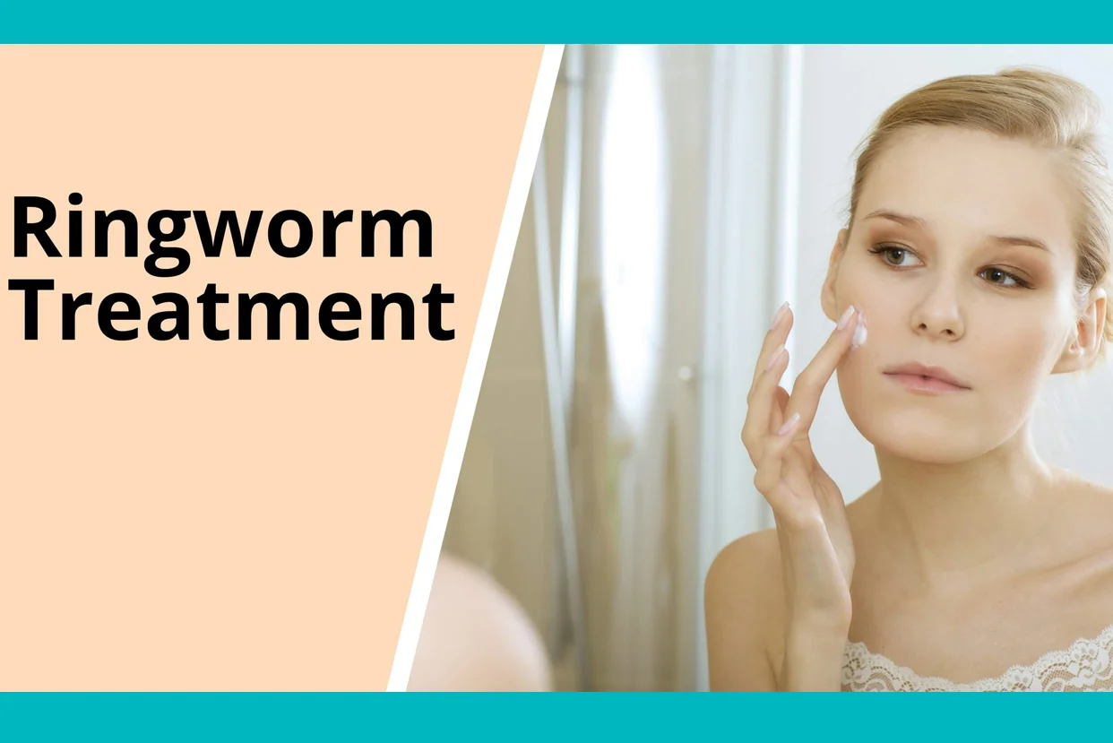 Ringworm Fungal Infection